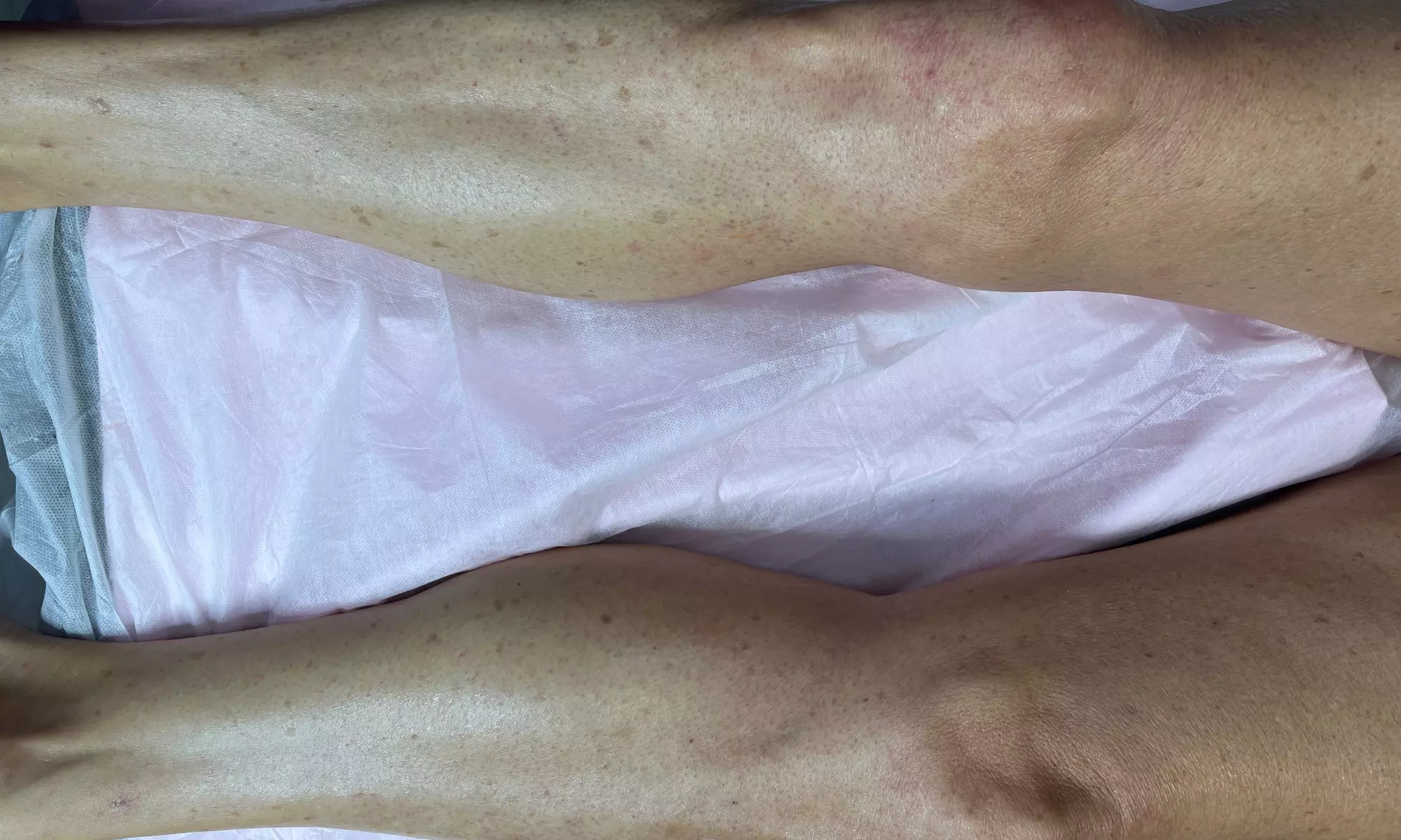 Expert Waxing & Targeted Hair Removal in a Professional Suite