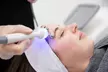 Up to 59% Off on Facial - HydraFacial at UK Aesthetics Lounge - Image 2