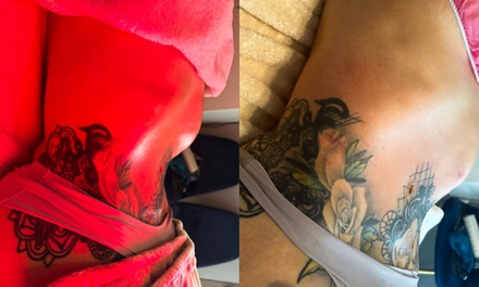 One 45 min lymphatic drainage - Skinology Lab