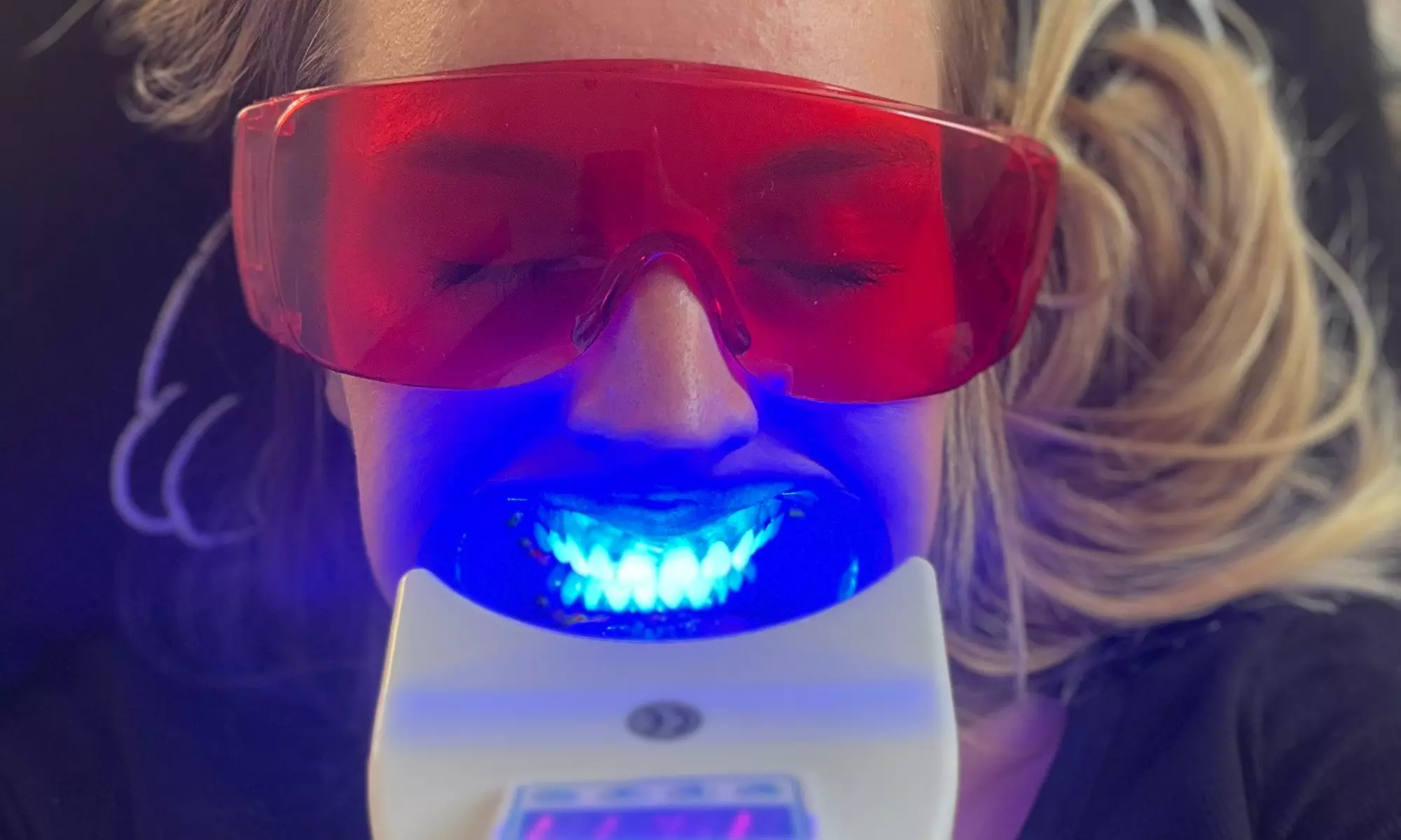 1 ou 2 séances de blanchiment dentaire au choix chez L’atelier de Chloé (jusqu'à 55% de remise) - Primary Image