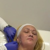 Image 2: Get 50, 100, or 150 Units of Dysport Treatments