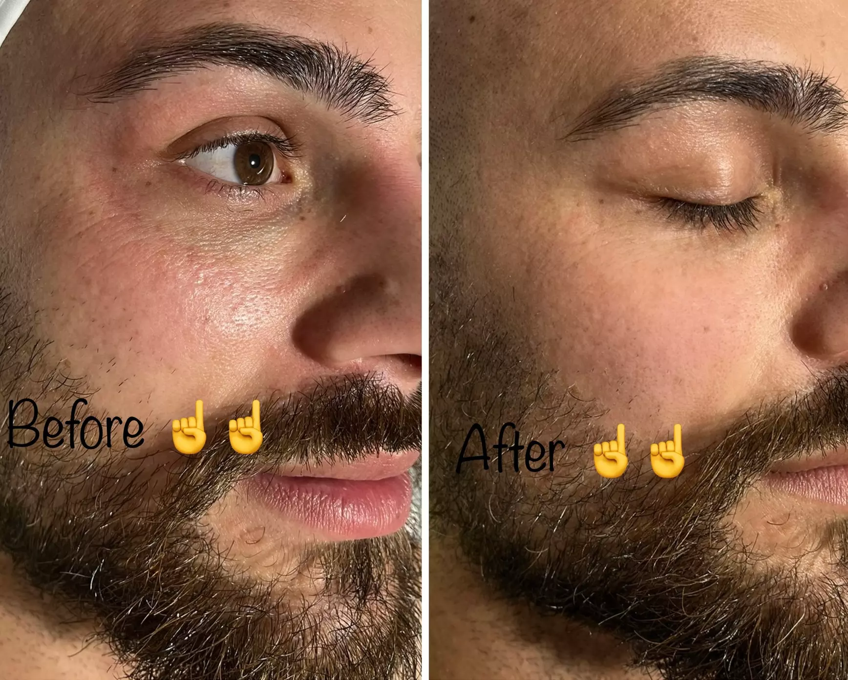 At Be Bare Skin, experience up to 50% off on a variety of facial options including a custom facial and enzyme DMK treatments - Primary Image