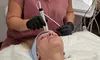 Achieve Radiant Skin w/ 1 Microdermabrasion Facial (45-Min) at Beauty Wellness CHI - Up to 60% Off