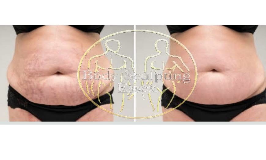 Image 3: Single or Two Area Sculpting, Private Sauna, Body Sculpt, & More