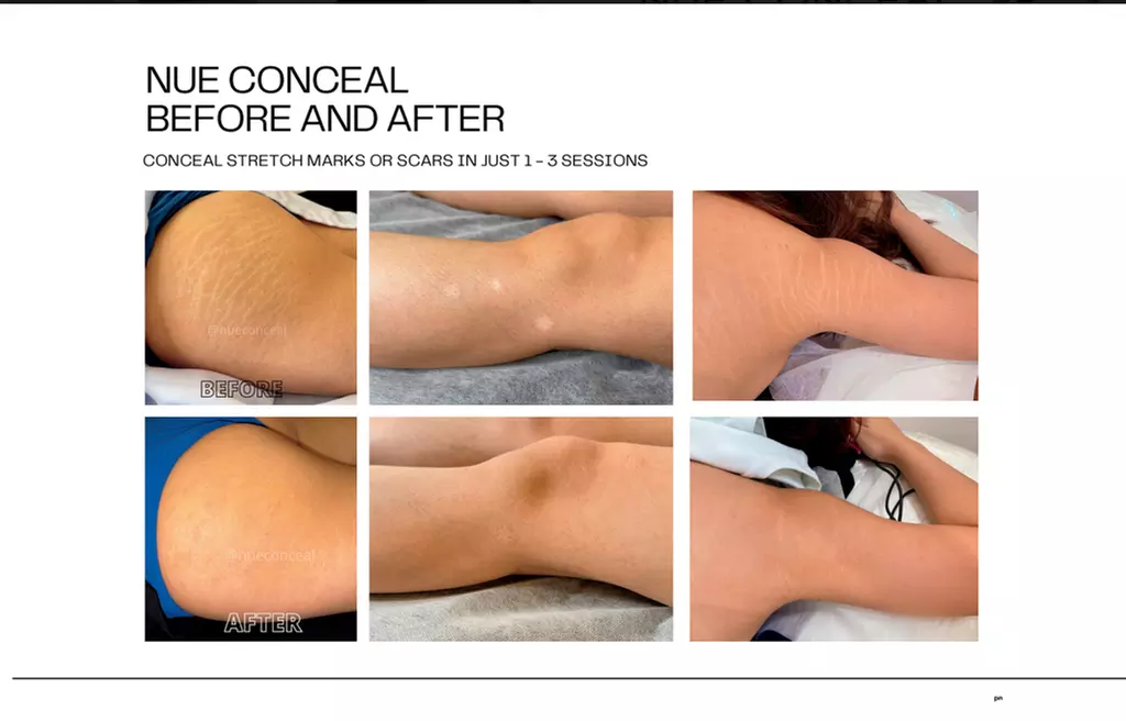 Up to 76% Off on Permanent Makeup at Scarless Artistry - Image 2