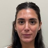 Image 3: Botox 20 - 40 units Lip Filler One Syringe