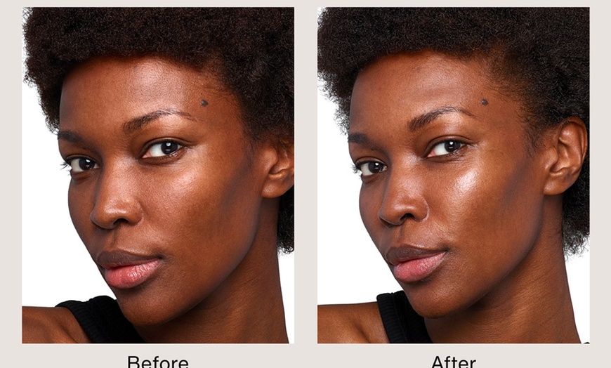 Image 1: Enhance Your Skin with Skinvive Microdroplet Hyalornic Acid Filler