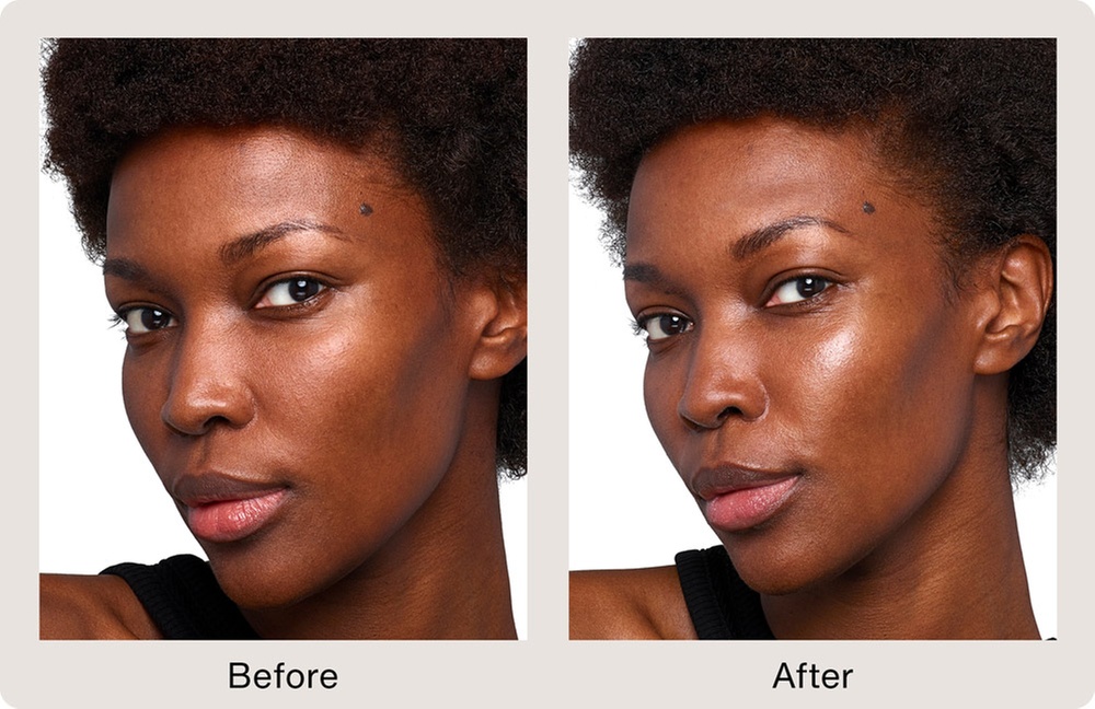 Enhance Your Skin with Skinvive Microdroplet Hyalornic Acid Filler