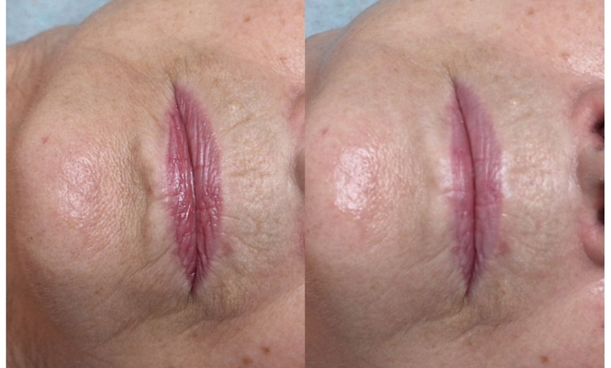 Image 7: Bis zu 35% Rabatt auf den Massage – Aromaöl bei Gym for skin Kosmetiksalon