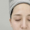 Image 2: Up to 60 Units of wrinkle-reducing cosmetic injection