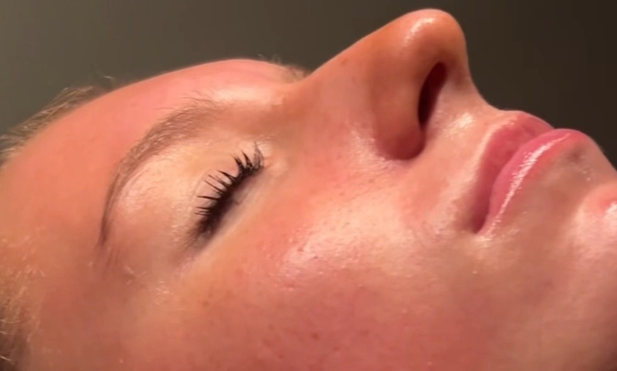 Image 2: Up to 24% Off on Facial – Exfoliation & Hydration (Device-Based) at Sensational Glow