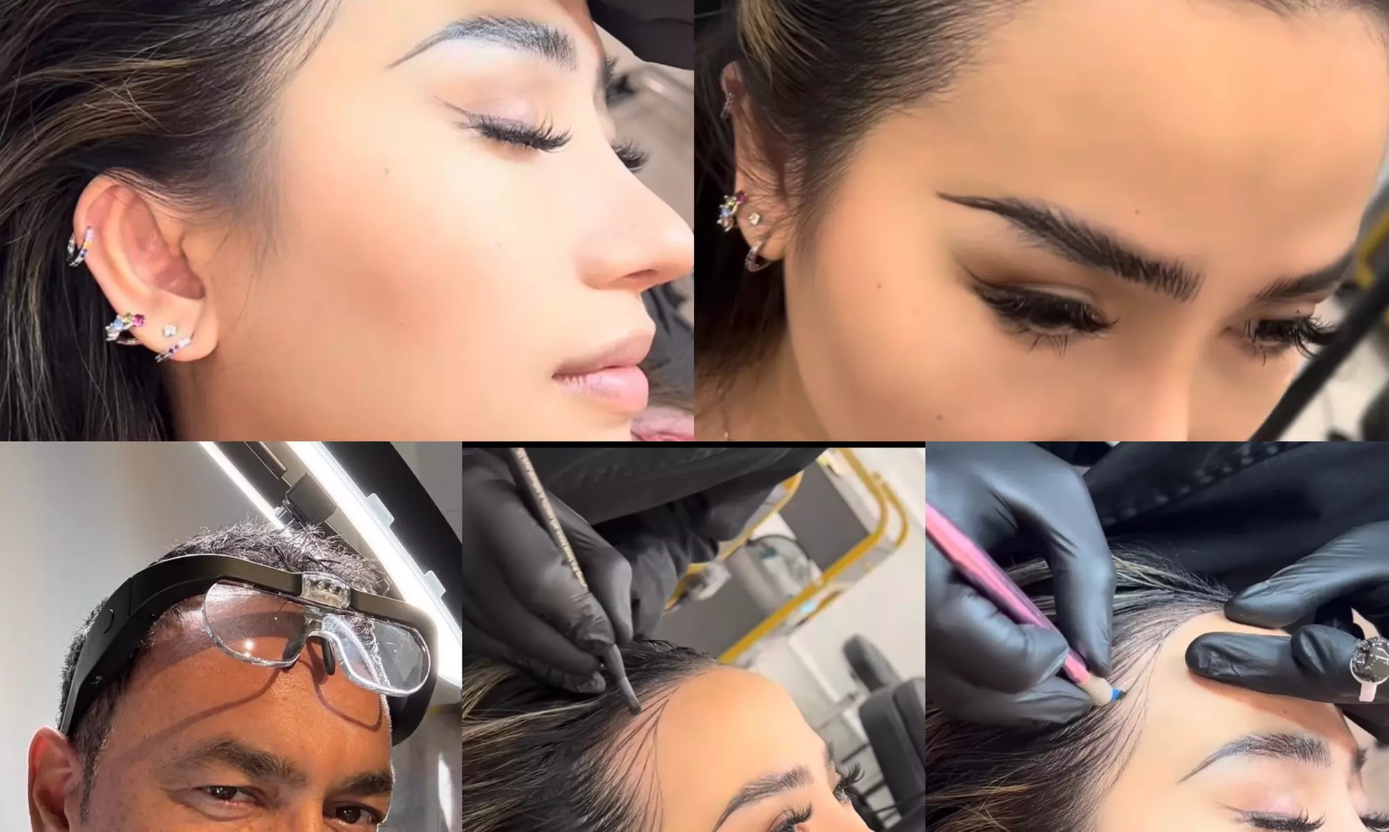 SMP Consultation w/ Hairline Focus, Density Boost for Hair Loss w/Care