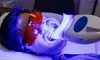 Brighten Your Smile with One or Three Teeth Whitening Sessions at Laser By Nicole Naples ( Up to 50% Off )