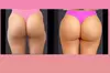 Discover JP Beverly Hills Skin Clinic's Non-Surgical Brazilian Butt Lift with Options and Up to 12% Off