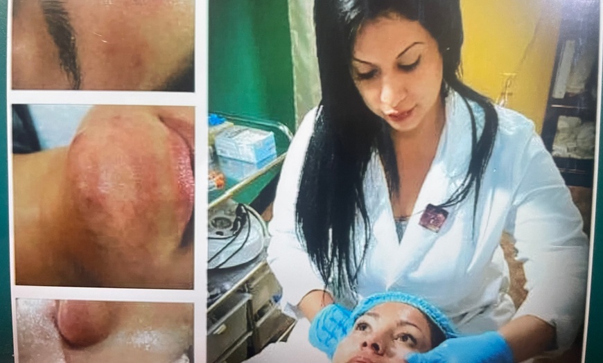 Image 1: 1, 2, or 3 Sessions RF Skin Tightening, Microdermabrasion &  Peel 