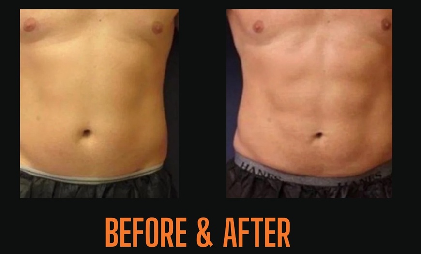 Image 8: Body Sculpting: Abs, Arms & Glutes (1–3 Sessions)