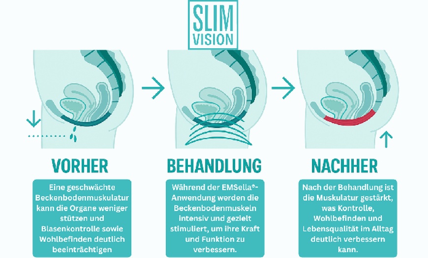Image 4: Bis zu 30% Rabatt auf den EMS (elektrische Muskelstimulation) bei Slimvision