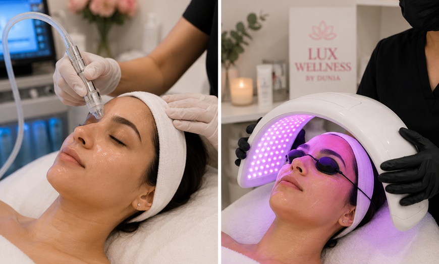 Image 3: Up to 56% Off on Chemical Peel at LuxwellnessbyDunia