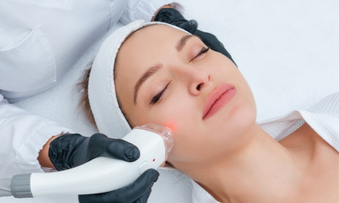 Get E-Light (IPL + RF) Treatment for the Face, Neck, Decollete