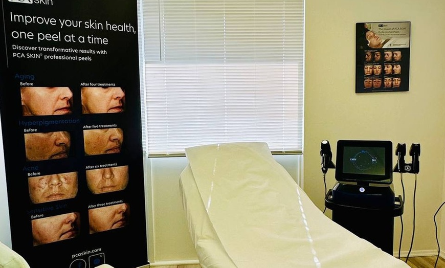 Image 2: Revitalize Your Face with RF Micro-Needling Session!