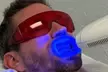30- or 60-Min Express or 60-Min In-Office Teeth Whitening with Optional High-Power Booster - Second Medium