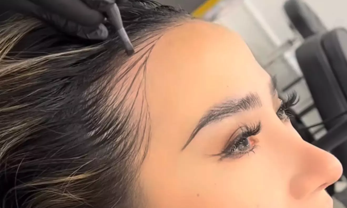 SMP Consultation w/ Hairline Focus, Density Boost for Hair Loss w/Care