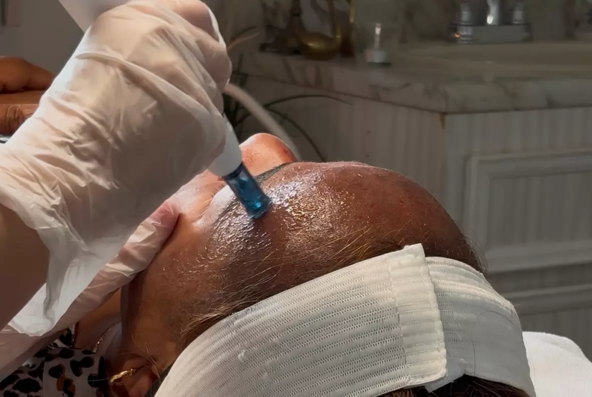 Up to 35% Off on  at Dermatone Skincare Studio