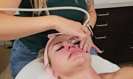 30% off Micro Facials - Everything Esthetics
