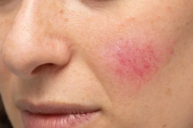 Gesichtsbehandlung oder Spezialbehandlung für Problemhaut für 1 Person