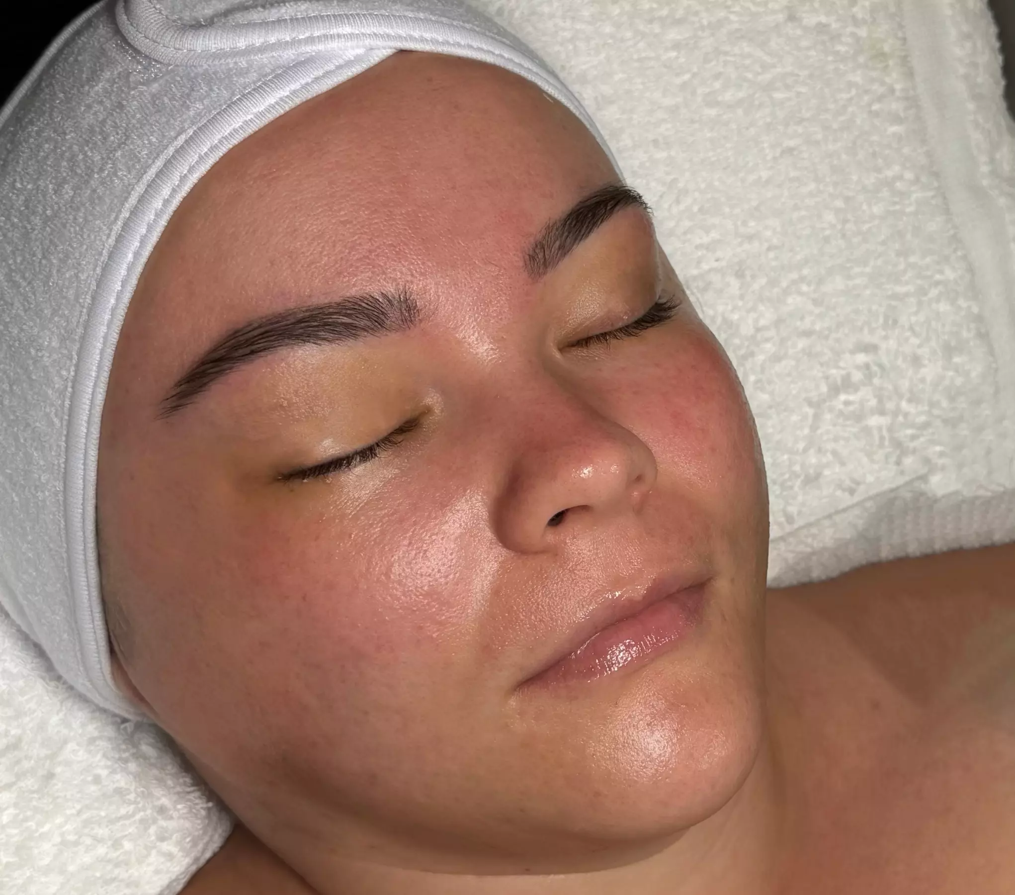 Achieve Radiant Skin with Dermaplane and Brazilian Wax