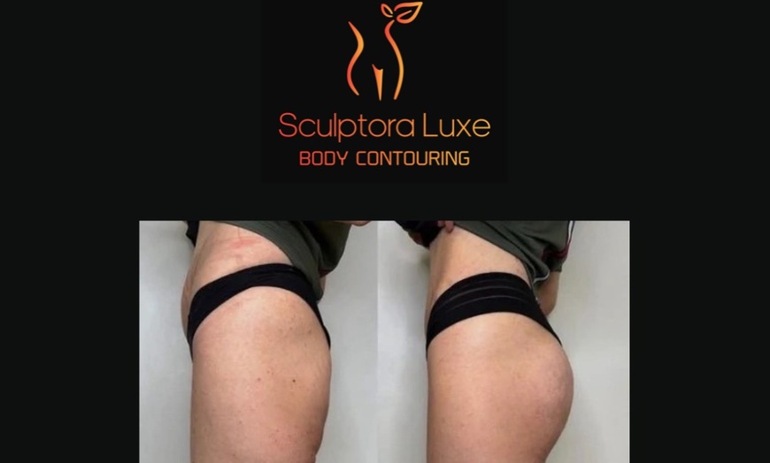 Image 6: Body Sculpting: Abs, Arms & Glutes (1–3 Sessions)