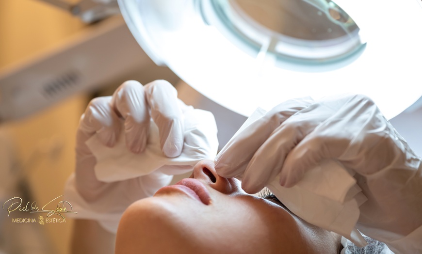 Image 6: Hasta 72% de dto. en Tratamiento facial en Piel de Seda