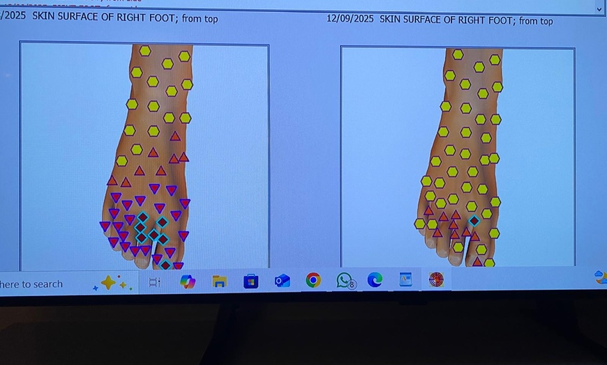 Image 5: Up to 60% Off on Body Scanning at Helixa Therapies Ltd