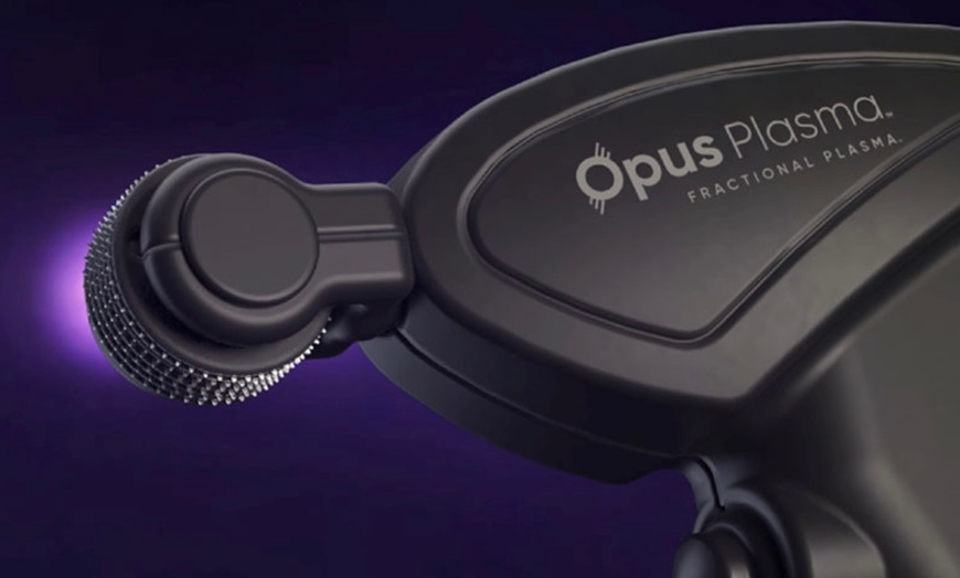 Image 2: Alma Opus Plasma Resurfacing for Wrinkles, Dark Spots & Skin Laxity