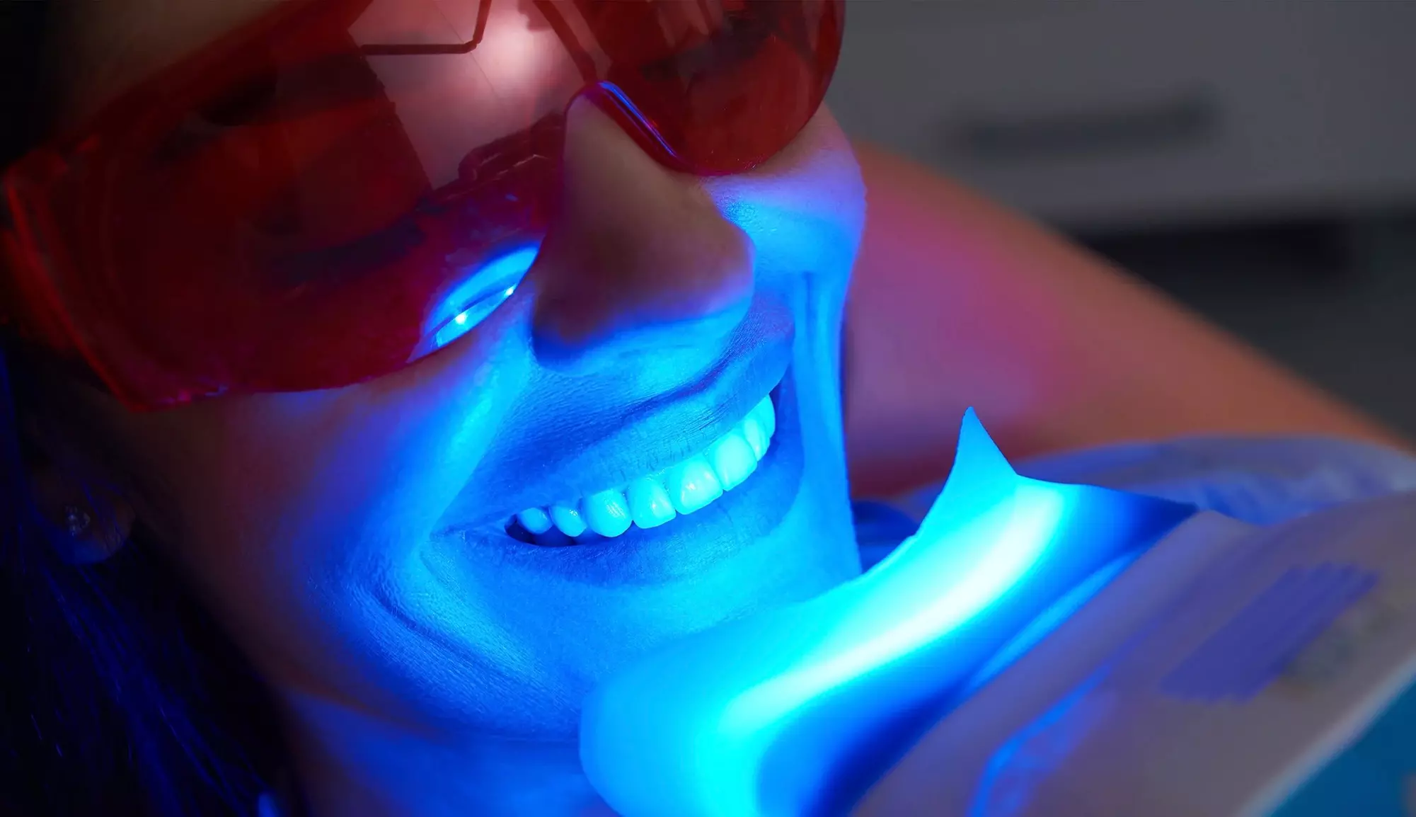 Brighten Your Smile w/ 1 or 2 Beaming White LED Teeth Whitening