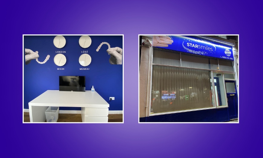 Image 4: Up to 67% Off on Invisible Aligners - StarSmiles Aligners