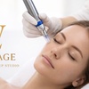 Image 1: Revitalize with One, Three, or Six Sessions of Micro-needling