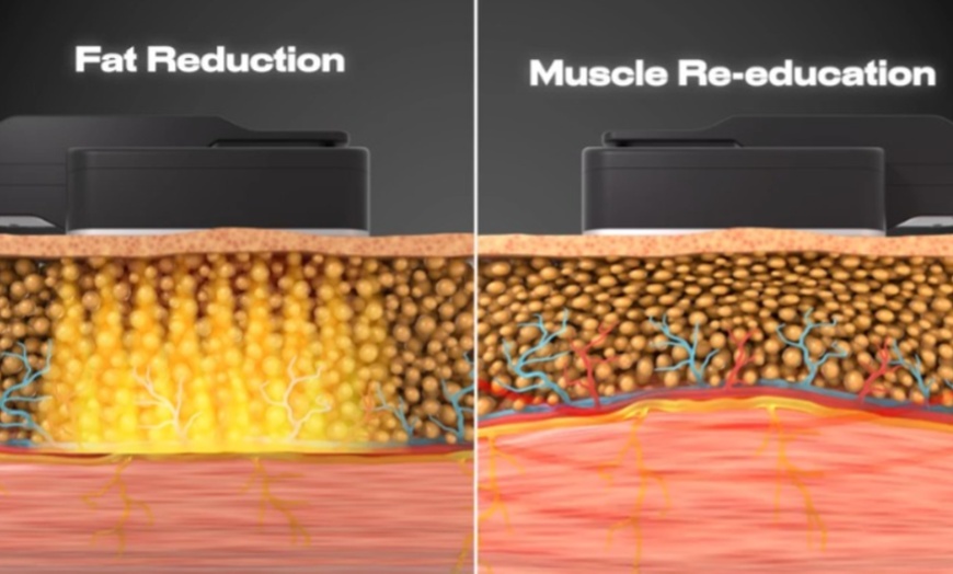 Image 2: One, Two, or Three 30 Minute Physiq360 Body Contouring Session