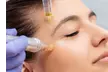 Revitalize Your Skin with One or Two PRP Facial Sessions with Microneedling or One PRP Injection (Up to 36% Off) - Second Medium