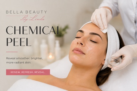 One Medical Grade  Jessner's Chemical Peel - Bella.lashesbylinda