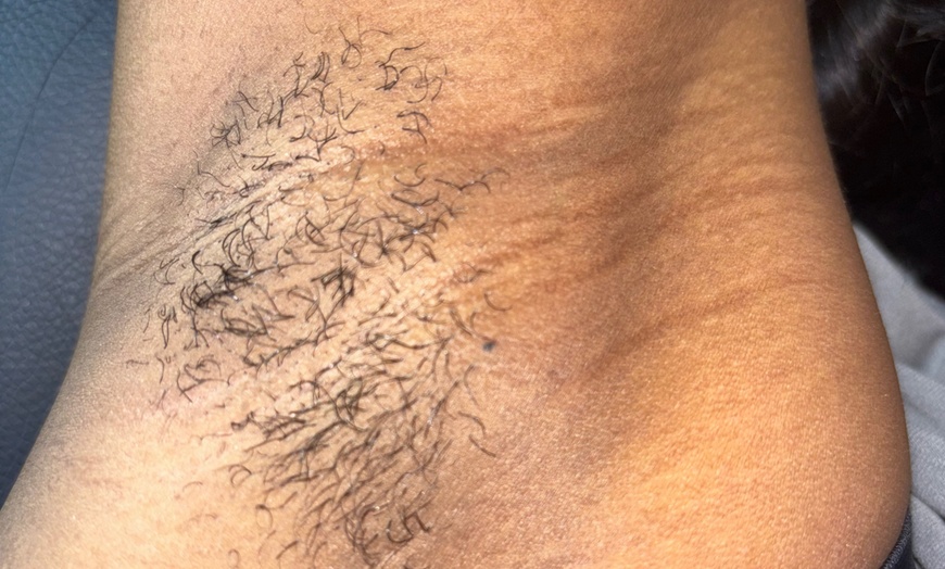 Image 9: Get Smooth with 1, 3, 5, or 10 Brazilian/Bikini Wax Sessions