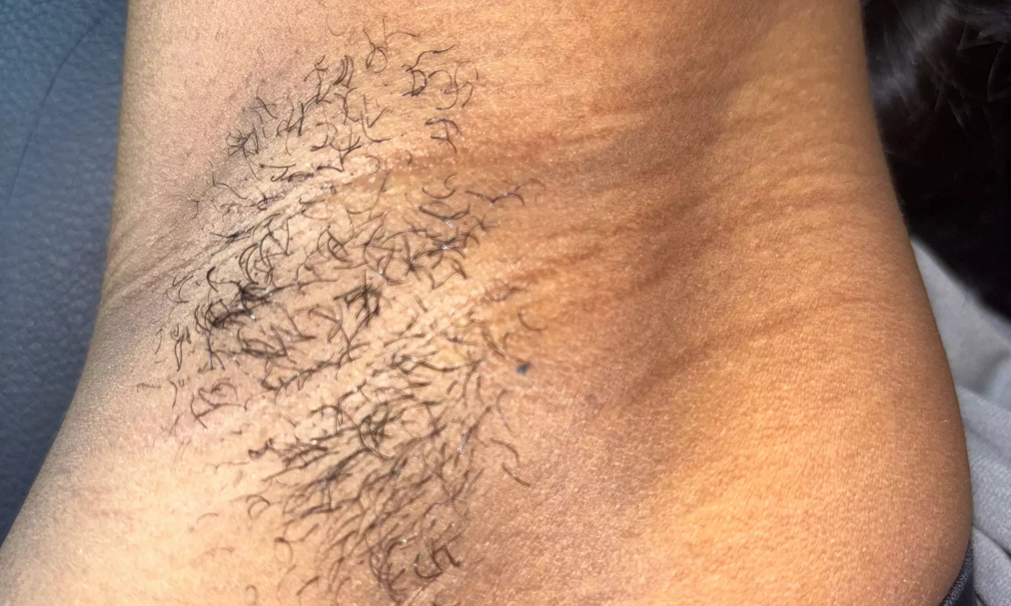 Get Smooth with 1, 3, 5, or 10 Brazilian/Bikini Wax Sessions