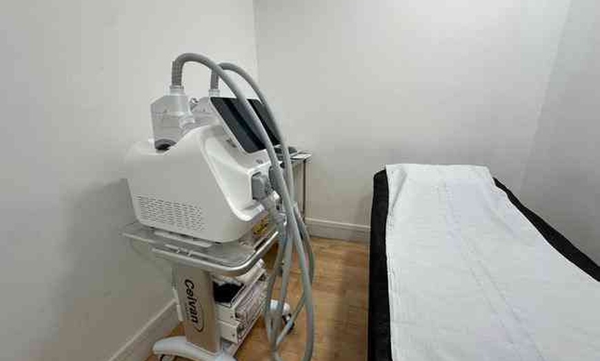 Image 5: 1, 2 o 4 sesiones de criolipólisis médica en zona a elegir