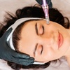 Image 1: Bis zu 50% Rabatt auf Micro-Needling bei Glow Spot