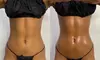 Up to 50% Off for Lymphatic Drainage Massage at Cali Bods 