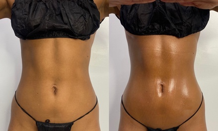 One 90-Minute Lymphatic Drainage Massage  with Ultrasound Fat Cavitation - Cali Bods