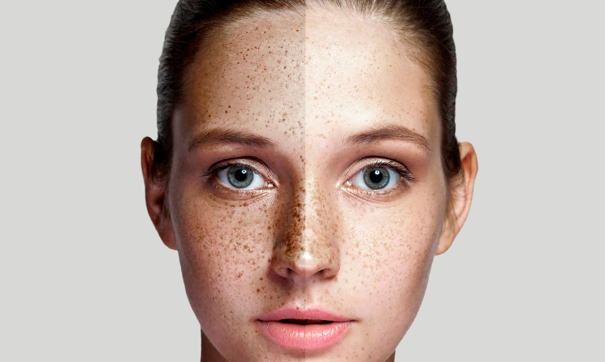 Target Pigment and Sun Damage with Laser Treatment Options