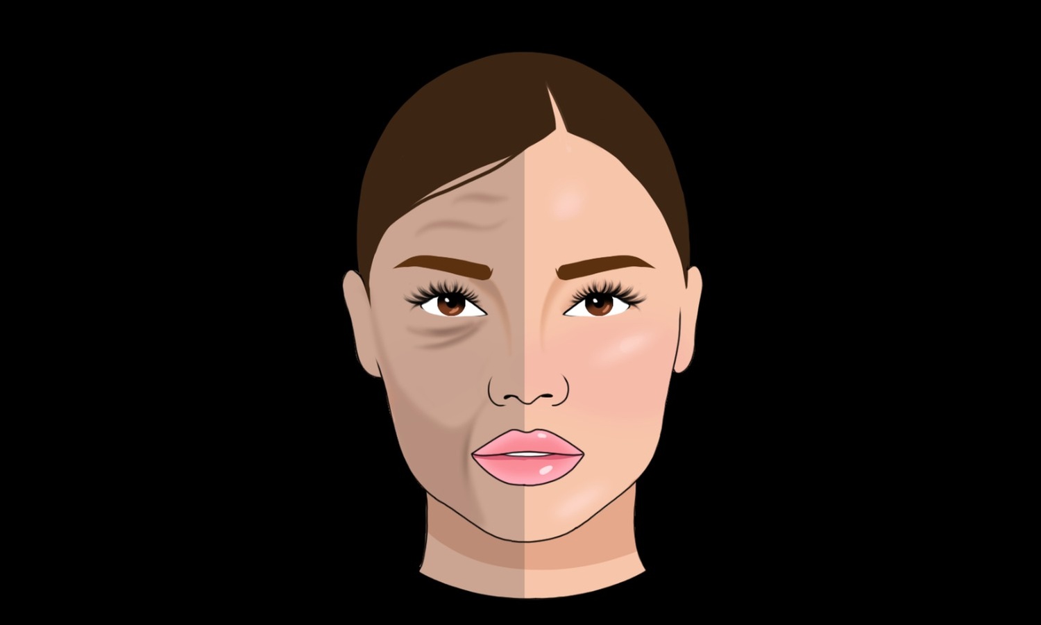 Experience the innovative BioRePeel Chemical Peel at Gentlelase Laser Aesthetics with no downtime, safe for all year use, up to 70% off - Primary Image