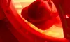 Choice of 1- , 3-, 5-, or 10-Red Light Therapy Sessions at BRC Mind and Body Wellness Spa (Up to 45% Off)