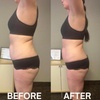 Image 4: Ultrasonic Cavitation Body Contouring with 1 3 6 or 9 Sessions 